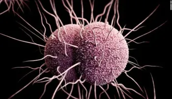Esta enfermedad de transmisión sexual se está volviendo cada vez más 'inteligente' y más difícil de tratar