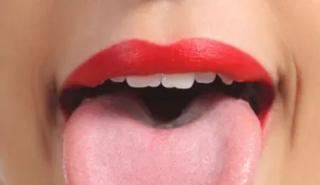 Tenía una capa blanca sobre su lengua, pero por suerte fue al médico justo a tiempo 