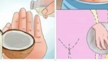 Manten al día tu higiene femenina y elimina las infecciones por hongos con aceite de coco