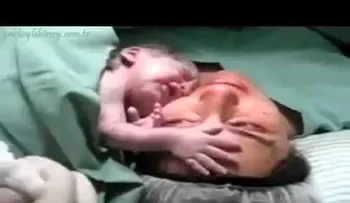 Un bebé recién nacido llora cuando lo alejan de su mamá