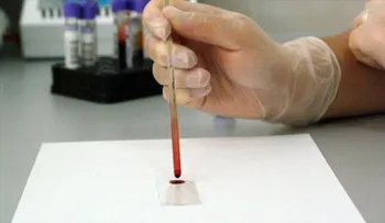 Vienen dos nuevos fármaco contra el cáncer hematológico e inmunoterapi