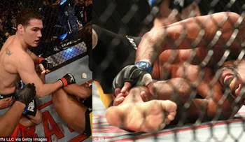  Vídeo: Espeluznante fractura de Anderson Silva en la UFC (se rompió la tibia)