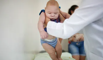 Más de 580 bebés fueron diagnosticados con microcefalia en Brasil