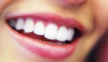 Una pasta casera para tus dientes sin manchas: Bicarbonato, agua oxigenada y fresa