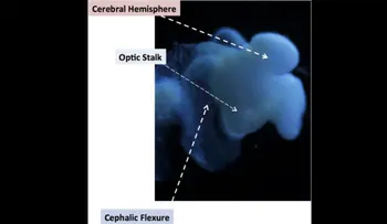 Científicos crean mini cerebros casi completamente humanos