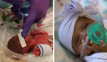 Dan de alta a la bebé considerada la más pequeña del mundo