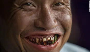 Nueces de betel: la mortal adicción en Asia