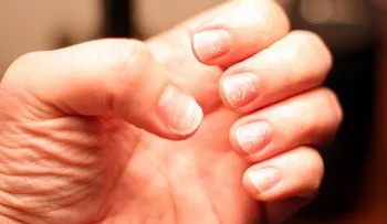 Cómo tener uñas más fuertes con el uso del ajo