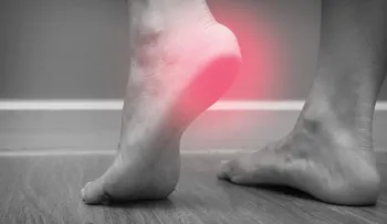 Causas del dolor de talón y como aliviarlo naturalmente