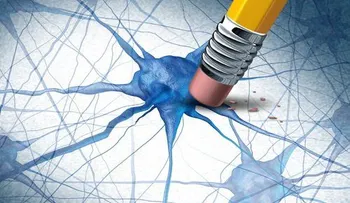 Cómo saber si padeces de Alzheimer