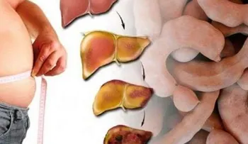 Mira lo que una sola fruta puede hacer por tu higado. Es increíble 