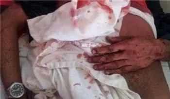 Matan a golpes ganadero Alberto Antonio Cabrera, de 64 años 