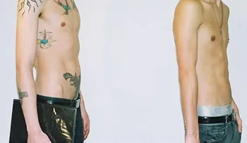 Chicas adolescentes podrían tener riesgo más alto de depresión