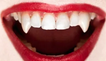 Ella permite que vampiros beban sangre de su cuerpo 