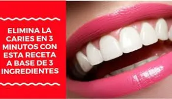 El truco para eliminar la caries en solo 20 minutos, que un odontólogo NUNCA te dirá 