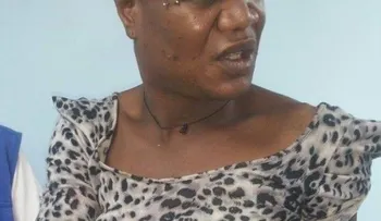 Hombre le propina disparo a homosexual haitiano al descubrir que no era una mujer