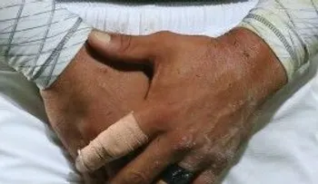 Hombre mata a otro al golpearlo en los testículos y provocarle cangrena
