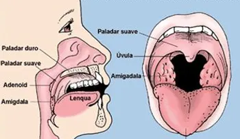 Remedios naturales para las adenoides: DR. Wilfredo Mañón