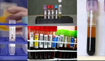 ¡Crisis! Laboratorios reciclan tubos de ensayo por escasez de insumos