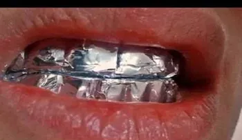 Esto le pasa a tus dientes si lo envuelves en papel aluminio (VIDEO)