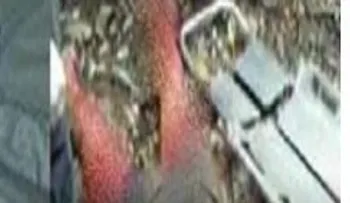 Un haitiano le propina 20 machetazos a una menor y le amputan las dos piernas; se debate entre la vida y la muerte 