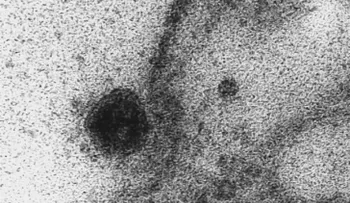 El momento exacto en que el coronavirus infecta una célula