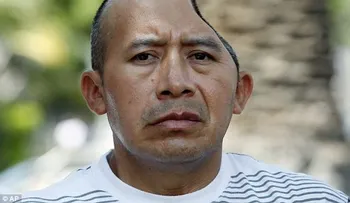 Hombre perdió parte de su cabeza recibe millonaria indemnización