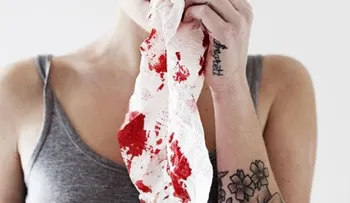 Día mundial de la Hemofilia: Enfermedad â??sangranteâ? que altera la vida