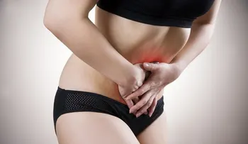 Los síntomas de la endometriosis que quizá desconozcas
