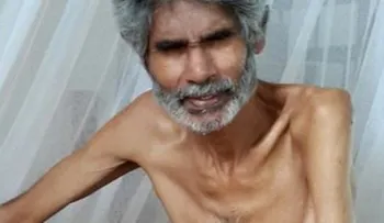 Hombre pasa 100 días en huelga de hambre en Trinidad y Tobago 