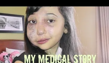 Una niña youtuber con una enfermedad rara emociona (VIDEO)