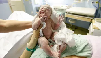 Mitos sobre el cordón umbilical enrollado en el cuello del bebé