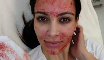 Por qué es bueno tomar tu propia sangre