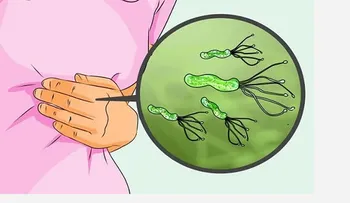 Médico Japonés revela como matar de raíz bacteria de Helicobacter Pylori