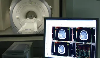 Descubren una nueva alteración en el cerebro de las personas con alzheimer