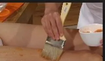 Remedios para eliminar las varices 