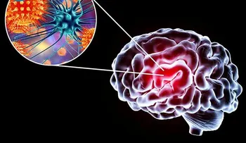Encefalitis viral aguda; diagnóstico y tratamiento