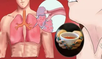 ¡Este poderoso té cura el asma de manera sorprendente!