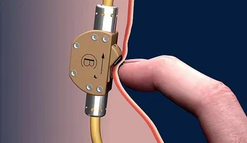 Este simple switch permite al hombre decidir si la embarazas o no (VIDEO)