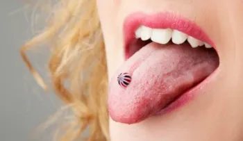 78% de quienes se perforan la lengua corren riesgos: 7 razones para no hacerlo
