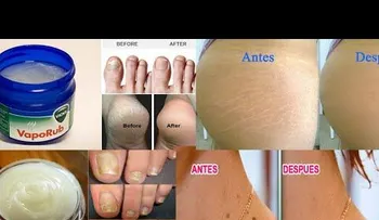 Entérate de estos usos increíbles del Vicks Vaporub, pero no lo ponga dentro de la nariz