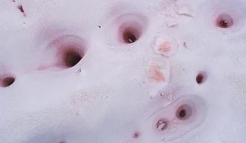 La peligrosa Nieve de Sandía