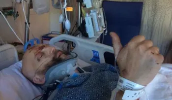 Un actor de Harry Potter está en grave estado tras un violento accidente de tránsito