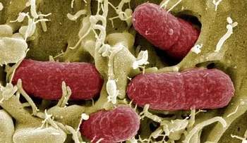 Bacteria resistente a antibióticos mata a 4 personas en Brasil