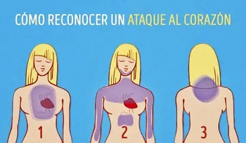 Cómo reconocer un ataque al corazón un mes antes de que suceda