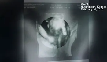 Asombrosa imagen de ultrasonido muestra a mellizo moribundo tomando la mano de su hermana