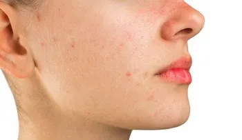Observa las consecuencias de dormir con maquillaje. No querrás hacerlo nunca más