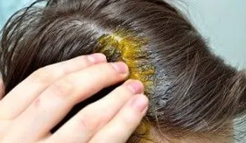5 consejos efectivos para evitar la caída del cabello