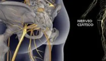 Imperdibles ejercicios para sanar cadera, espalda y el nervio ciático