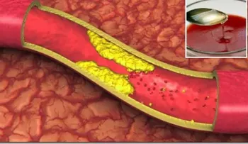 Un vaso diario de este jugo por 30 días te dejará las arterias como nueva 